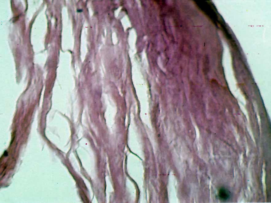 fig1